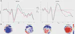 Electrophysiology of non-literal language